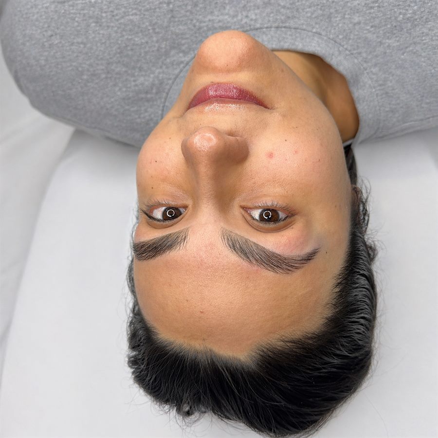 Cejas despu&eacute;s caso 2