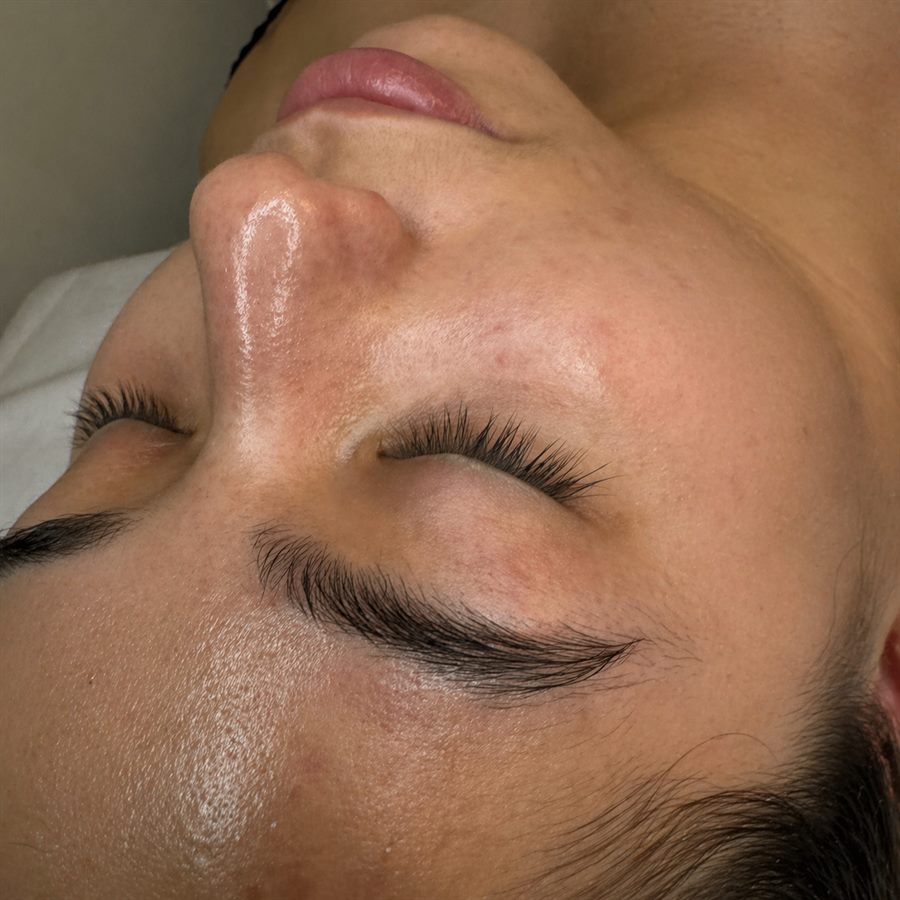 Cejas antes caso 1