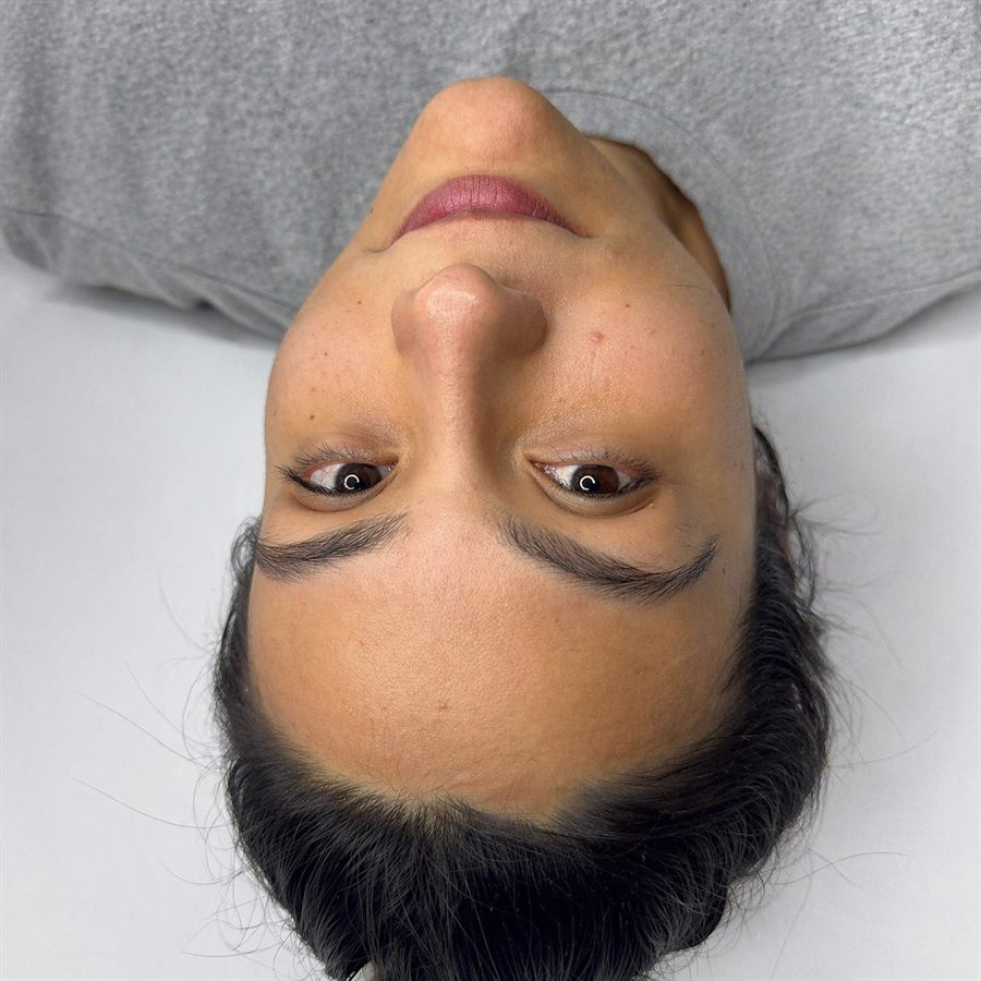 Cejas antes caso 2