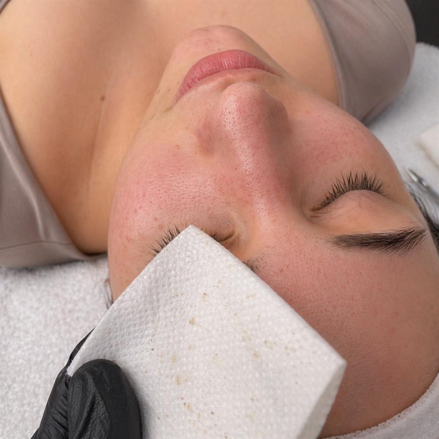 Limpieza Facial Profunda